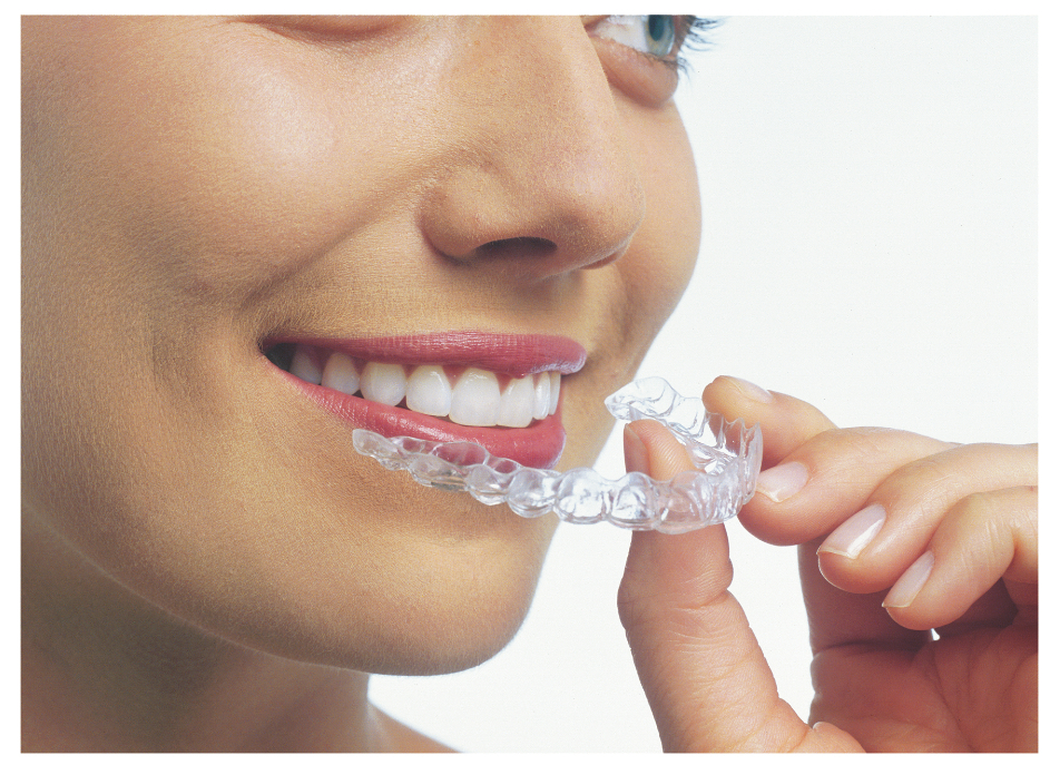 INVISALIGN, THE STRAIGHTEST WAY TO A GREAT SMILE - Dr. Rita The